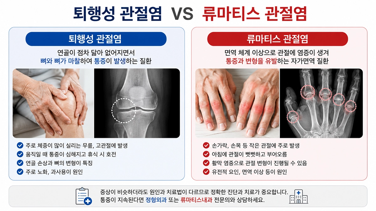 퇴행성 관절염과 류마티스 관절염 차이