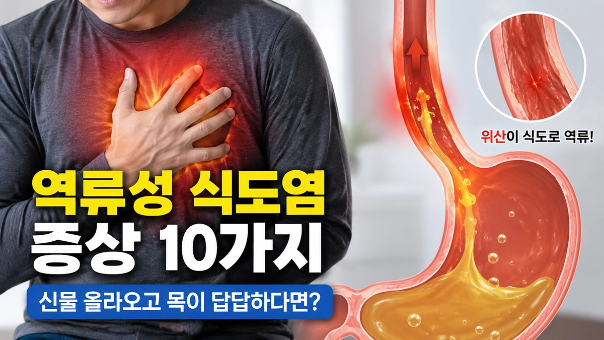 역류성 식도염 증상과 원인을 설명하는 이미지