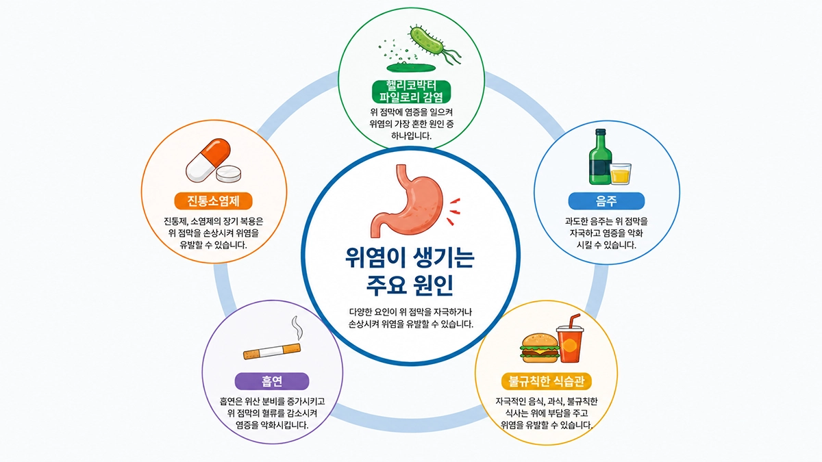 위염 원인으로 알려진 헬리코박터 감염 약물 음주 흡연 식습관 요인을 정리한 이미지