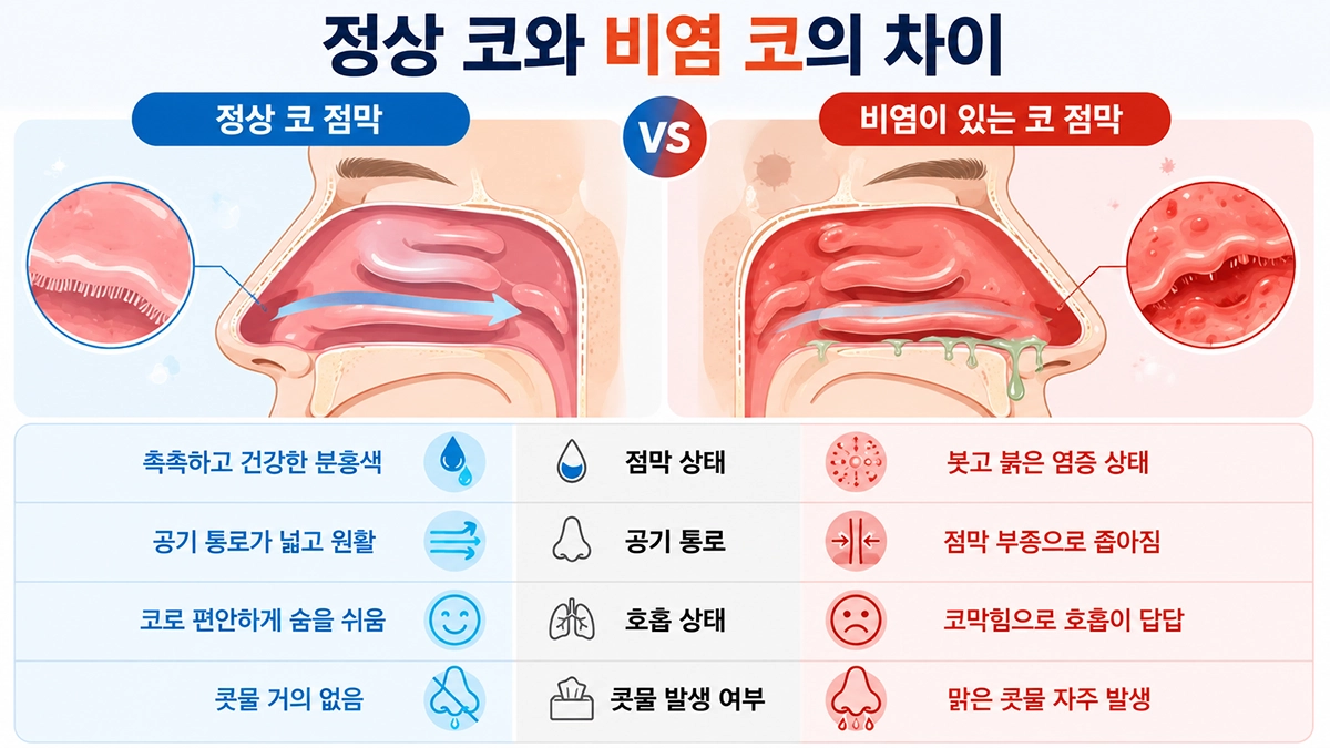 정상 코 점막과 비염 점막의 차이를 비교한 이미지