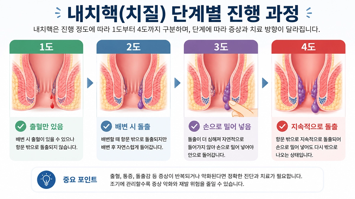 내치핵 1도 2도 3도 4도 단계별 특징 이미지