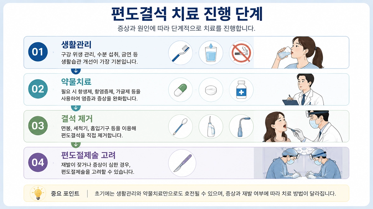 편도결석 치료 방법과 관리 순서 설명 이미지