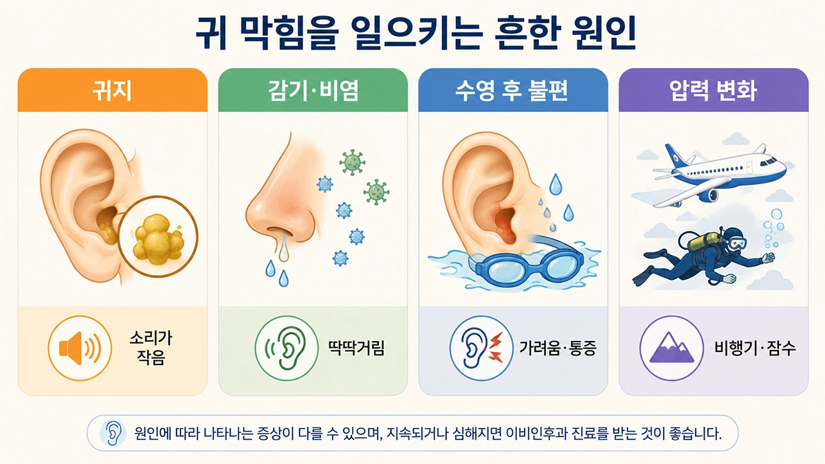 귀지와 감기, 수영, 압력 변화로 생길 수 있는 귀 막힘 원인을 비교한 이미지