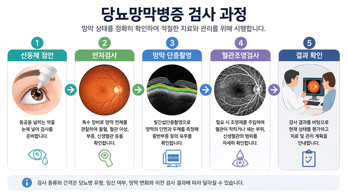 당뇨망막병증 검사 과정인 산동 안저검사와 망막 단층촬영 단계