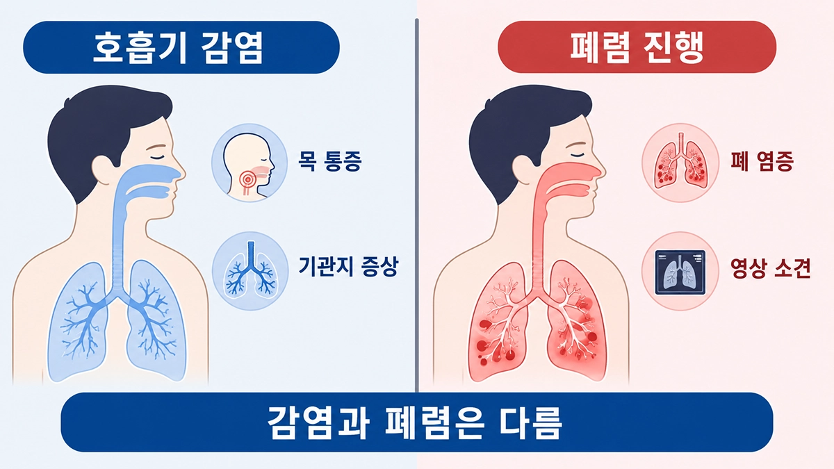 마이코플라스마 폐렴과 일반 호흡기 감염의 차이를 비교한 그림
