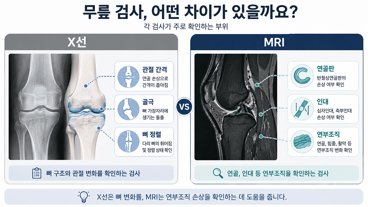 무릎관절염 증상 평가에 사용하는 X선과 MRI 검사 차이 비교