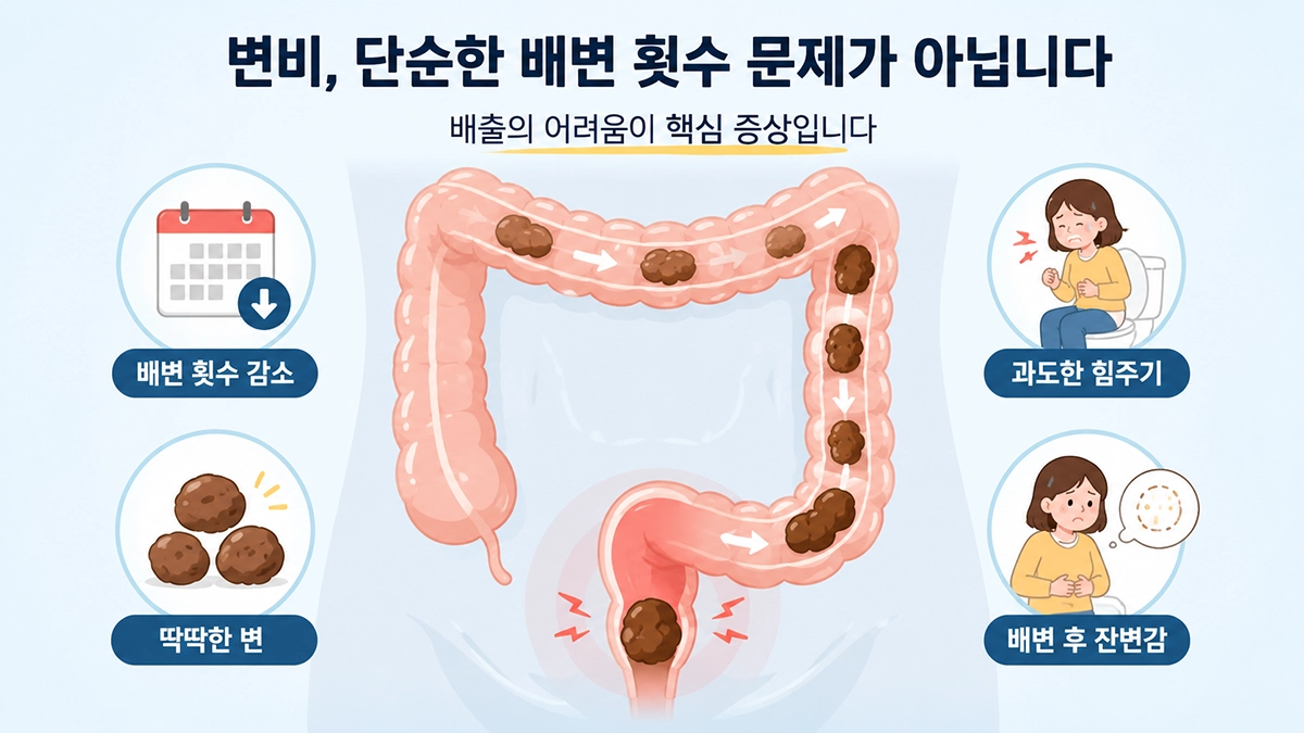 변비 증상과 원인을 보여주는 대장 구조와 딱딱한 변·잔변감 인포그래픽