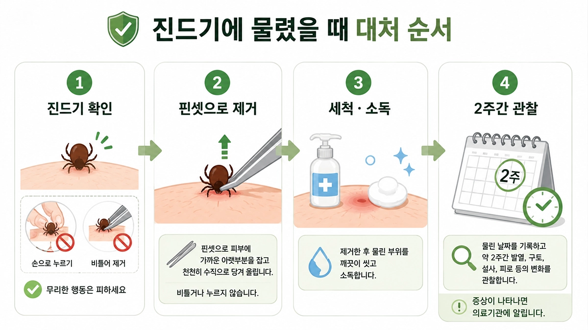 SFTS 증상 관찰을 위해 진드기 물림 후 핀셋 제거와 세척, 2주간 관찰 과정을 설명한 이미지