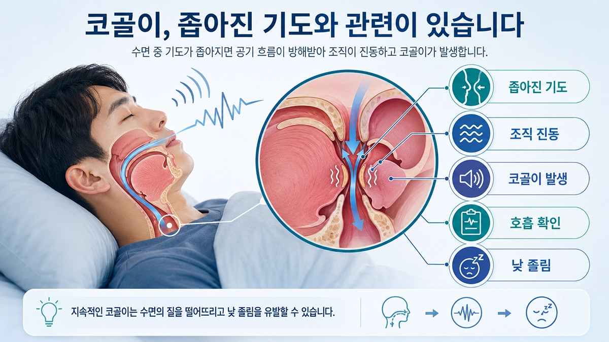 코골이 발생 과정과 좁아진 기도를 보여주는 상기도 인포그래픽