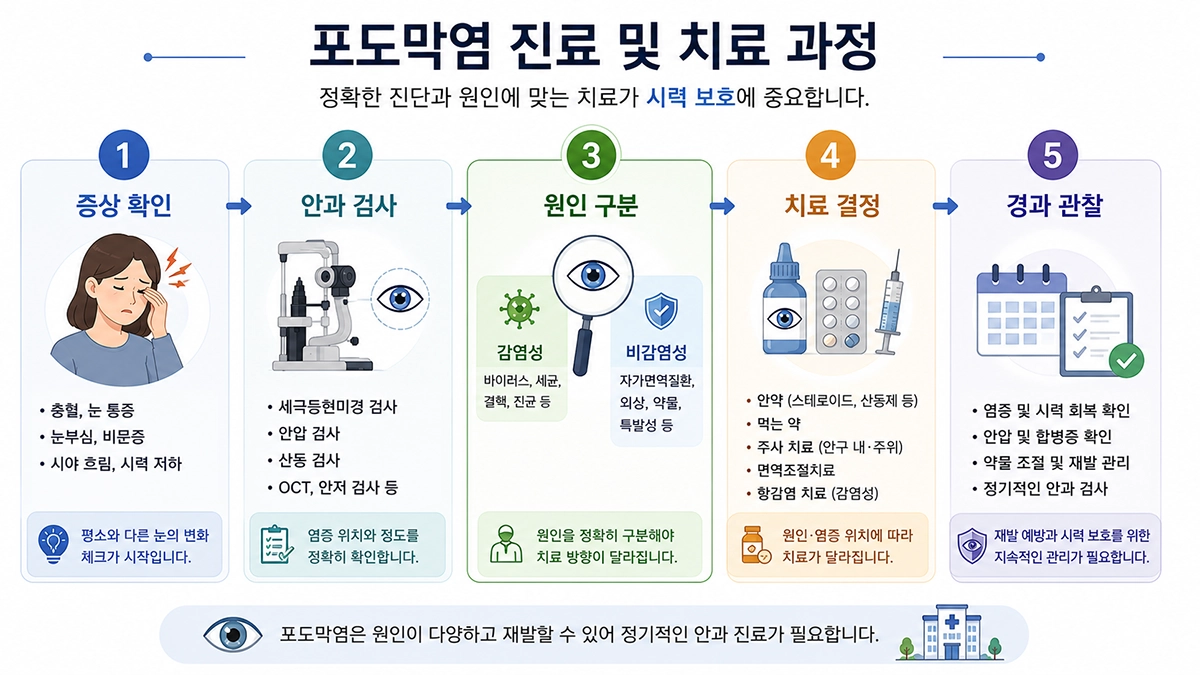 포도막염 증상 확인부터 안과 검사와 치료 및 경과 관찰까지의 진료 과정