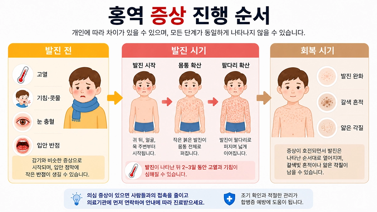 홍역 증상과 발진이 얼굴에서 몸통과 팔다리로 퍼진 뒤 회복되는 순서를 보여주는 인포그래픽