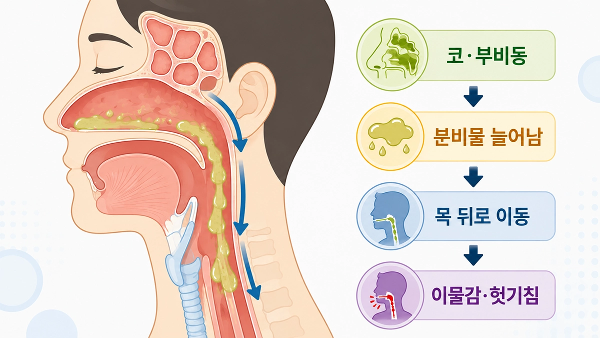 후비루로 코와 부비동의 분비물이 목 뒤로 흐르는 과정을 보여주는 인포그래픽