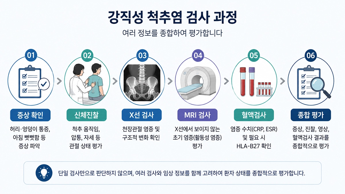 강직성 척추염 진단에 활용되는 신체진찰 X선 MRI 혈액검사 과정