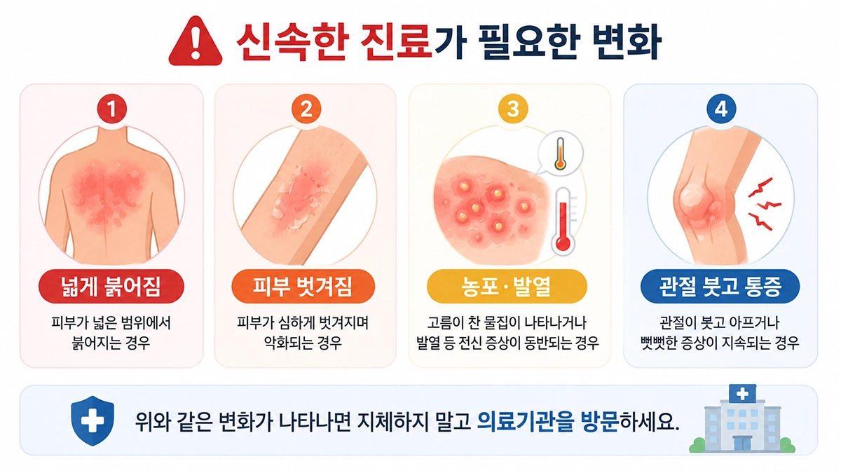 건선에서 피부가 넓게 붉어지거나 농포와 관절 통증이 나타날 때 진료가 필요한 상황을 정리한 이미지