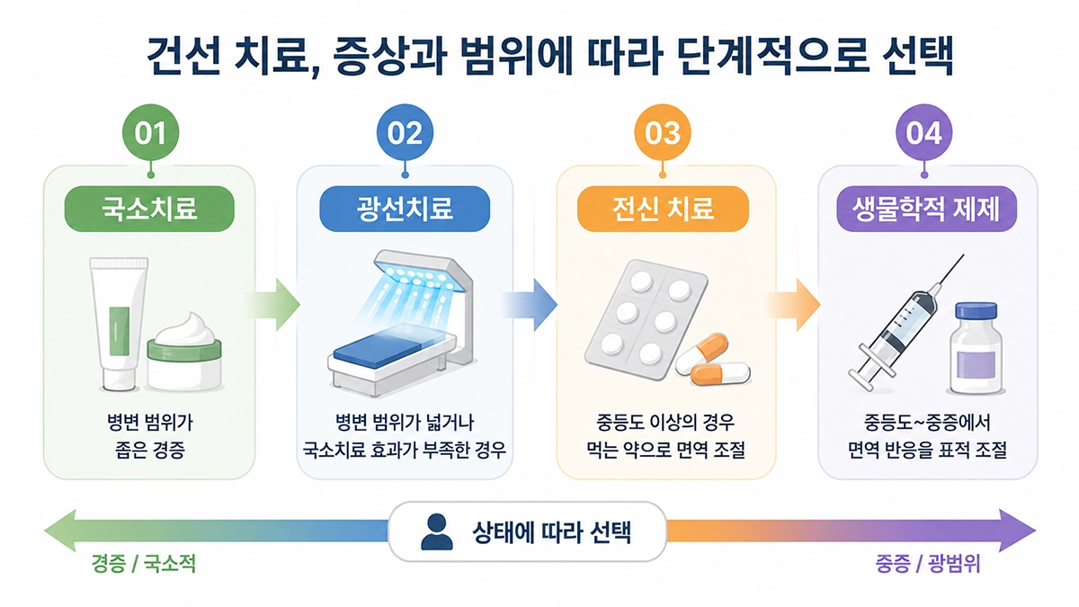 건선의 중증도와 치료 반응에 따라 국소치료부터 광선치료와 전신 치료까지 선택되는 과정을 보여주는 이미지