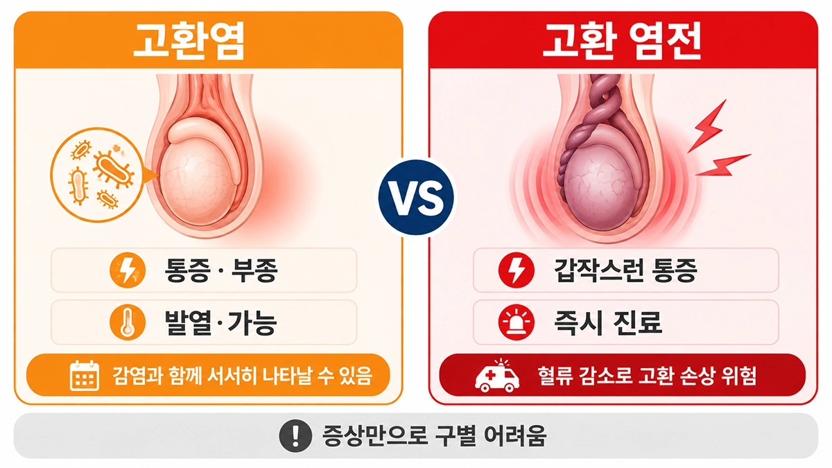 고환염과 고환 염전의 통증 양상과 응급 진료 필요성을 비교한 이미지