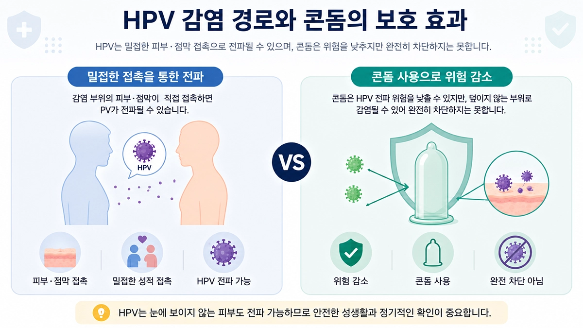 곤지름 HPV 감염경로와 콘돔 사용 시 전파 위험 감소의 한계를 비교한 인포그래픽
