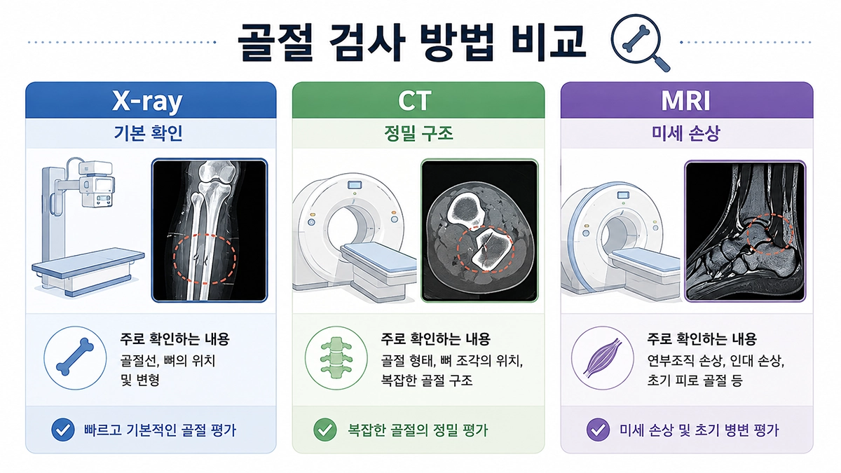 골절 검사에 사용되는 X-ray CT MRI의 확인 범위를 비교한 인포그래픽