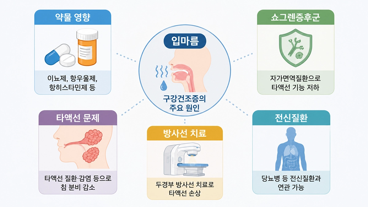 구강건조증 원인으로 알려진 약물, 쇼그렌증후군, 타액선 질환과 전신질환을 정리한 인포그래픽