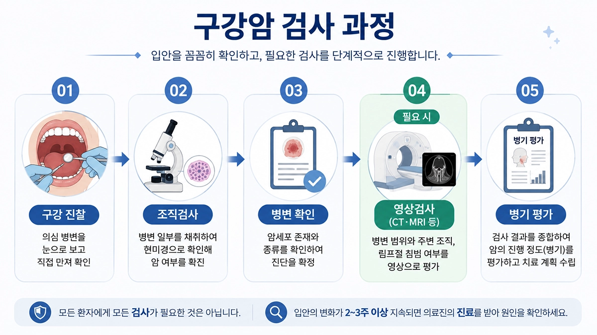 구강암 초기증상 확인 후 구강 진찰과 조직검사, 영상검사로 이어지는 검사 과정