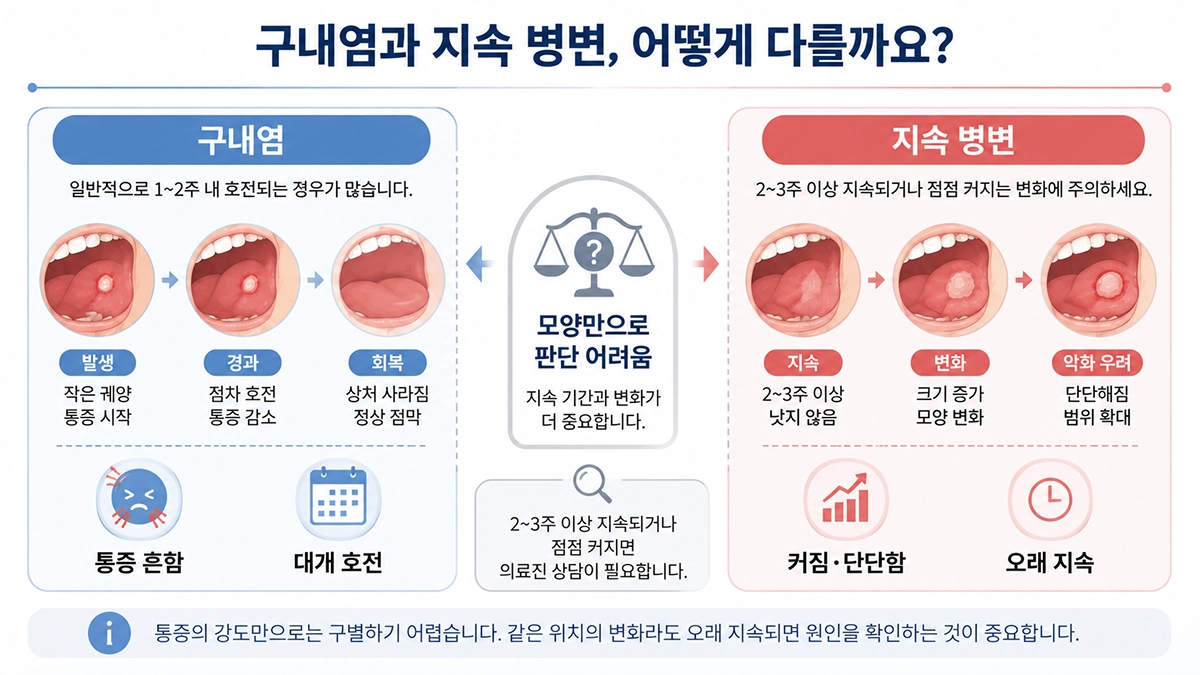 구강암 초기증상과 구내염의 지속 기간 및 변화 차이를 비교한 인포그래픽