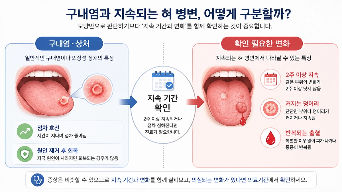 설암 초기증상과 혼동할 수 있는 구내염 및 오래 지속되는 혀 병변의 차이를 비교한 인포그래픽