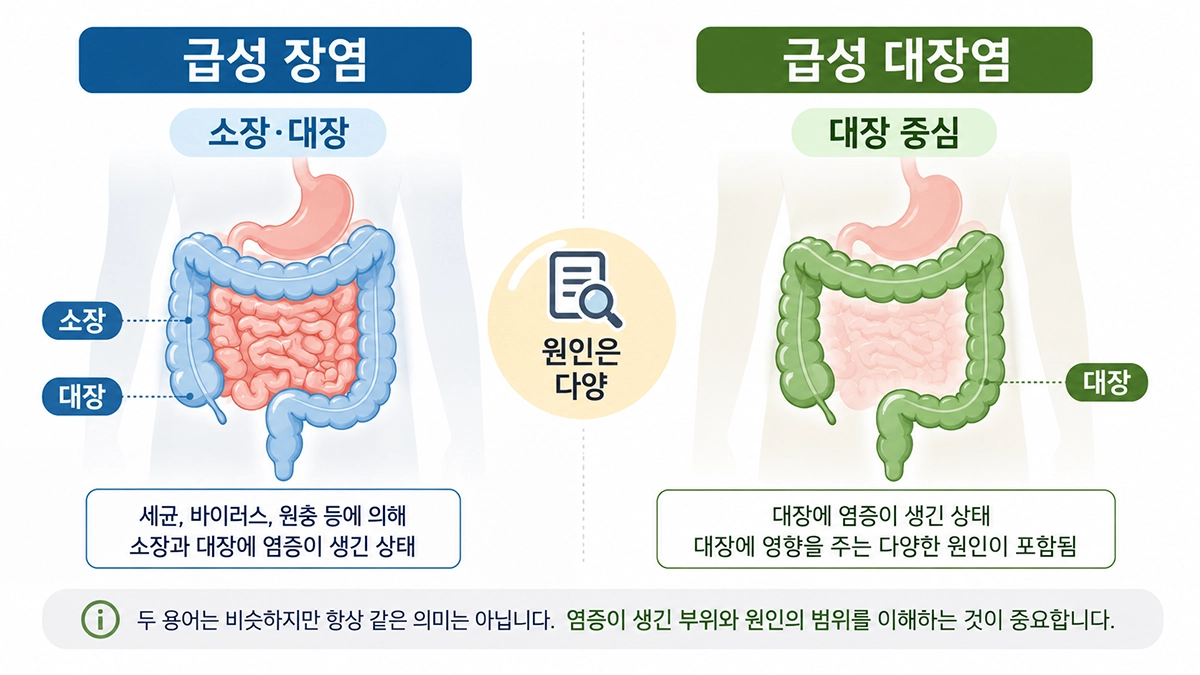 급성 대장염과 급성 장염의 침범 부위 차이를 비교한 인포그래픽