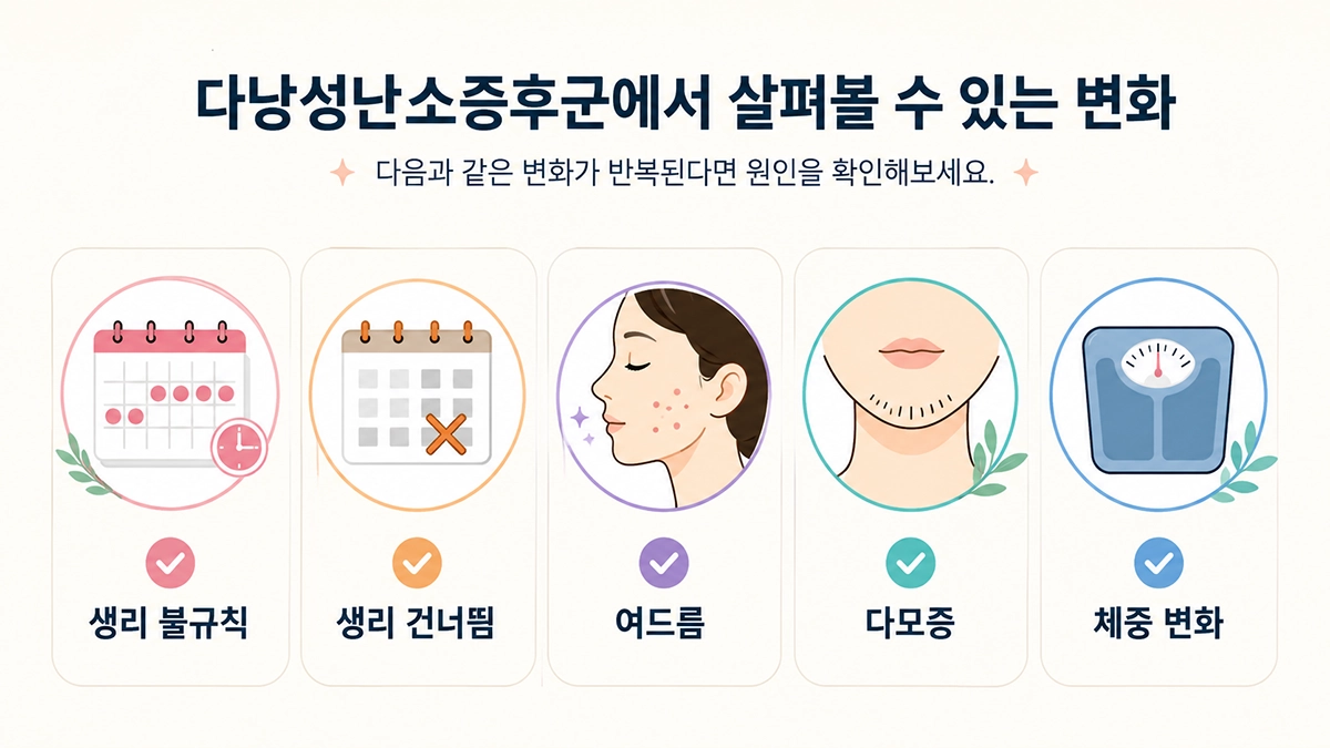 다낭성난소증후군에서 나타날 수 있는 생리 불규칙, 여드름, 다모증과 체중 변화를 정리한 이미지