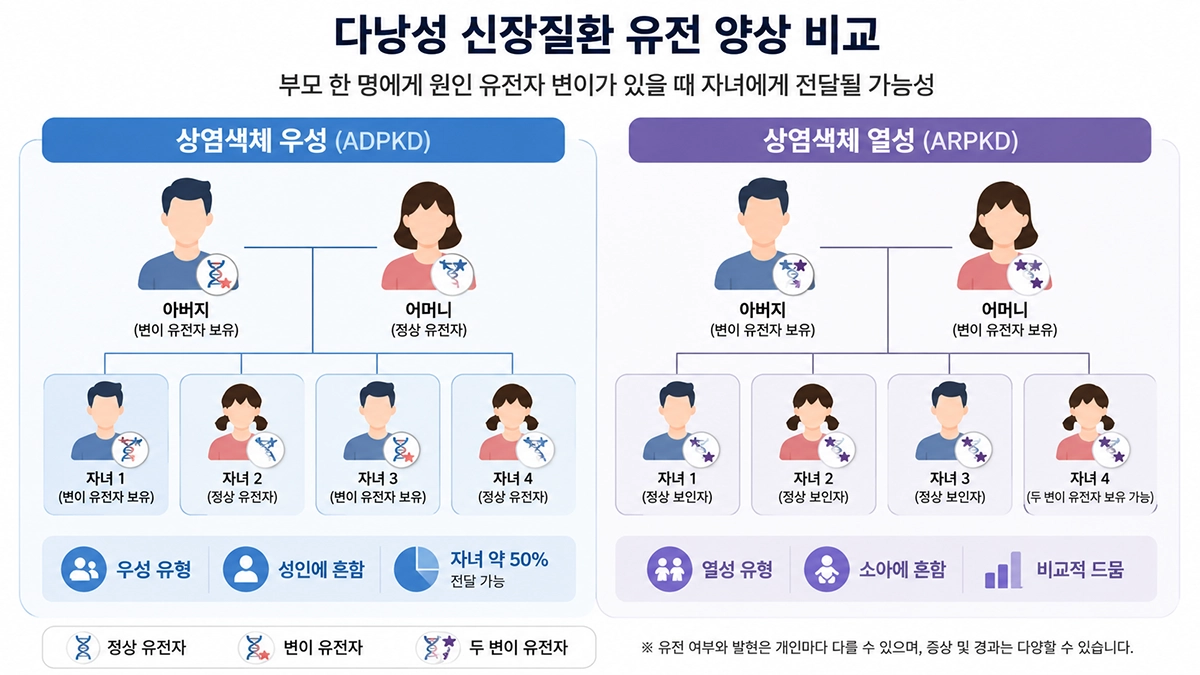 다낭성 신장질환의 상염색체 우성 유형과 열성 유형의 유전 차이를 비교한 인포그래픽