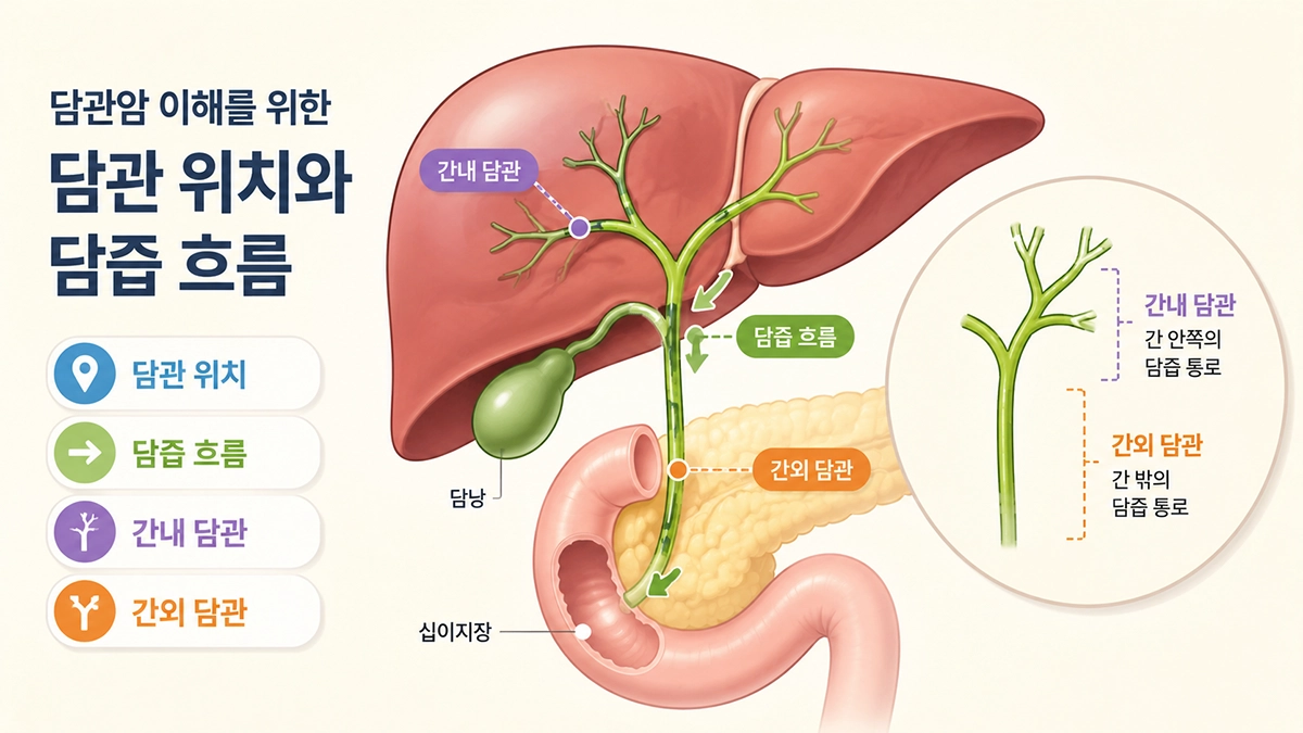 담관암이 발생하는 간내 담관과 간외 담관의 위치를 보여주는 인포그래픽