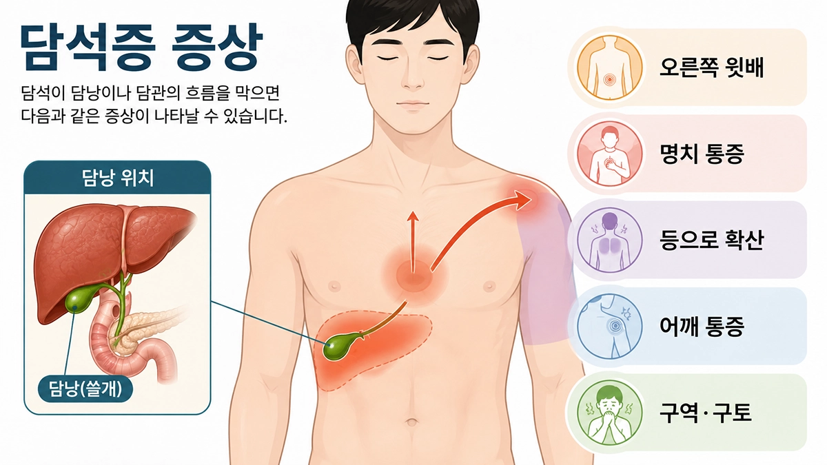담석증 증상으로 나타날 수 있는 오른쪽 윗배와 명치, 등과 어깨 통증 위치