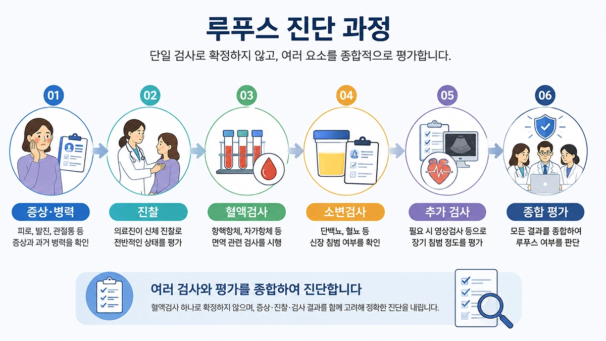 루푸스 진단에서 증상과 병력, 혈액검사, 소변검사 등을 종합하는 과정을 보여주는 인포그래픽
