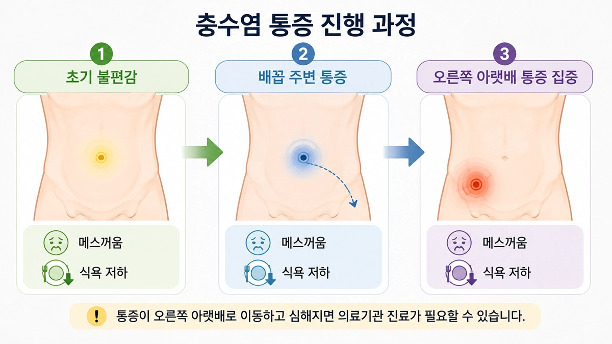 맹장염 초기 증상과 충수염 통증이 오른쪽 아랫배로 이동하는 과정