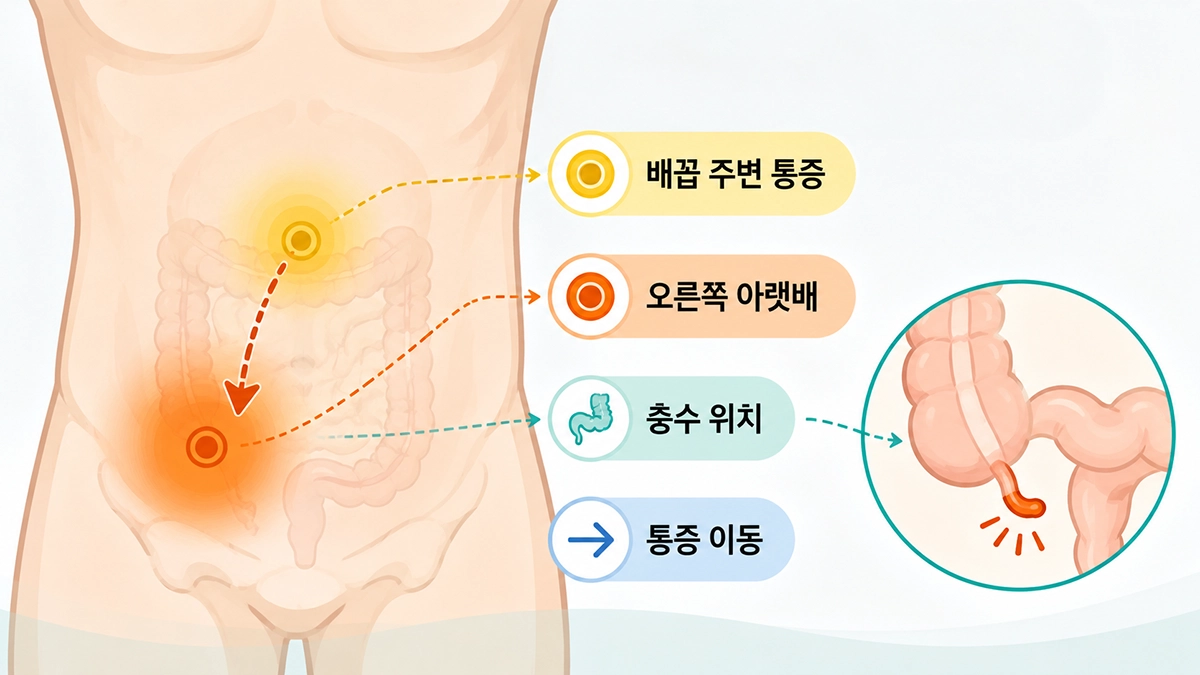 맹장염으로 불리는 충수염의 위치와 배꼽 주변에서 오른쪽 아랫배로 이동하는 통증