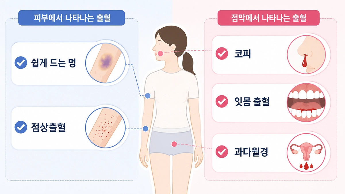 면역혈소판감소증에서 나타날 수 있는 멍, 점상출혈, 코피, 잇몸 출혈과 과다월경 증상