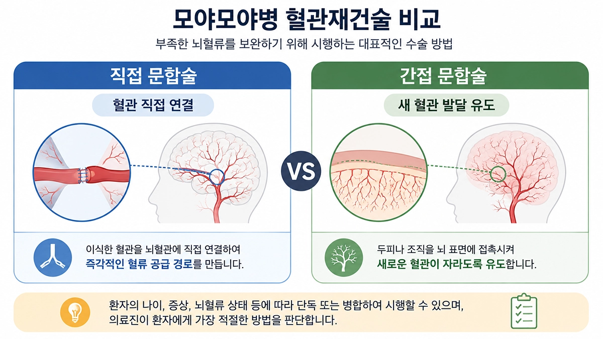 모야모야병 혈관재건술의 직접 문합술과 간접 문합술 비교
