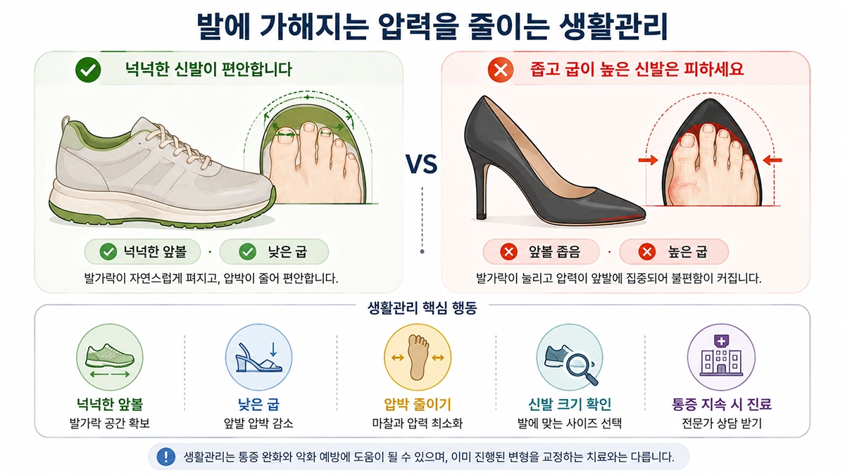 무지외반증 생활관리에서 앞볼이 넉넉한 신발 선택과 발 압박을 줄이는 방법을 설명한 이미지
