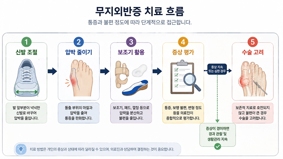 무지외반증 치료에서 신발 조절과 보조기 사용부터 필요 시 수술을 고려하는 과정을 정리한 이미지