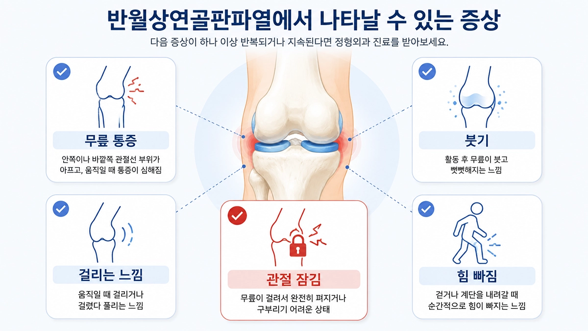 반월상연골판파열에서 나타날 수 있는 무릎 통증과 붓기, 걸림, 관절 잠김 증상