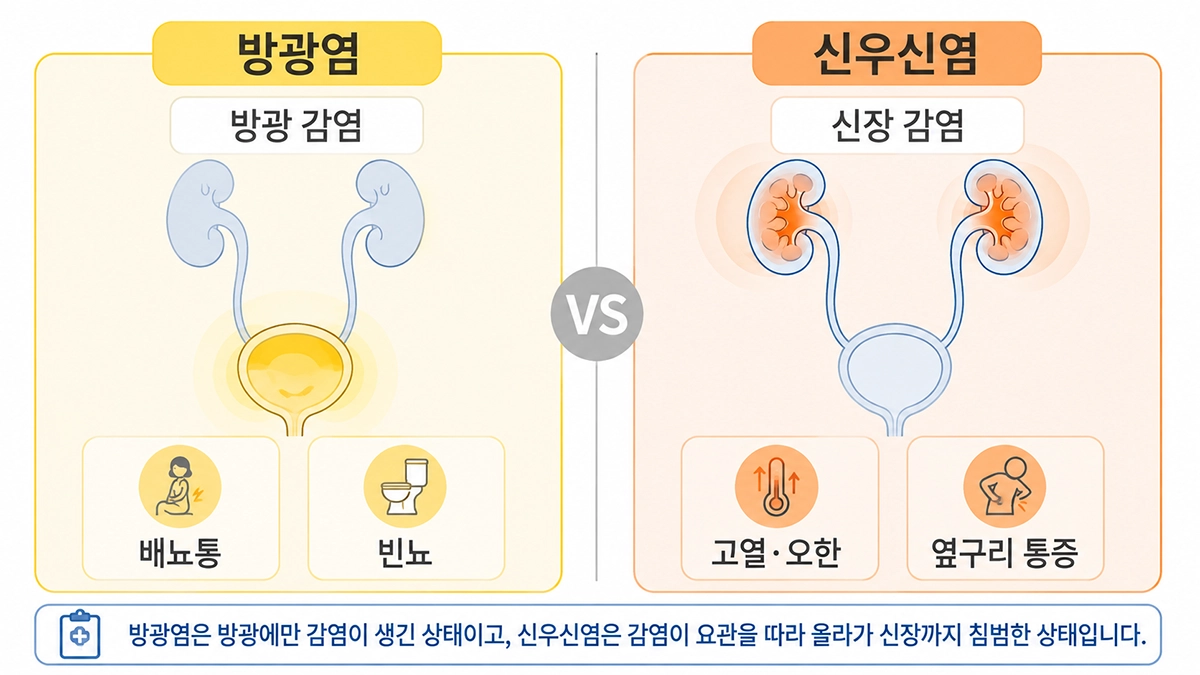 신우신염 증상과 방광염 증상의 차이를 비교한 인포그래픽