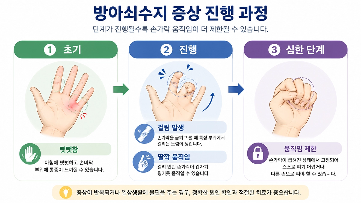 방아쇠수지 증상이 뻣뻣함에서 손가락 걸림과 움직임 제한으로 진행되는 과정