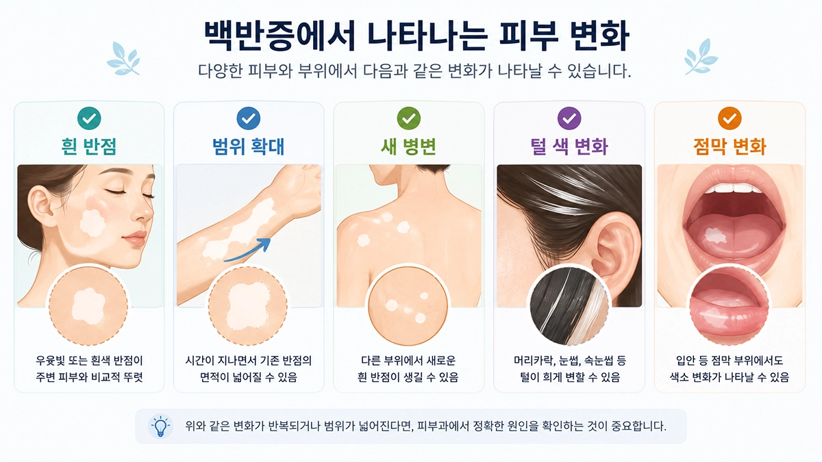 백반증에서 나타날 수 있는 흰 반점과 범위 확대, 털 색 변화의 특징