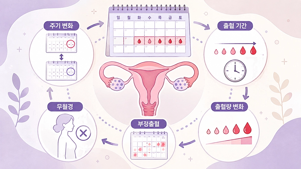 생리불순으로 나타날 수 있는 생리 주기와 출혈량 변화를 설명한 인포그래픽