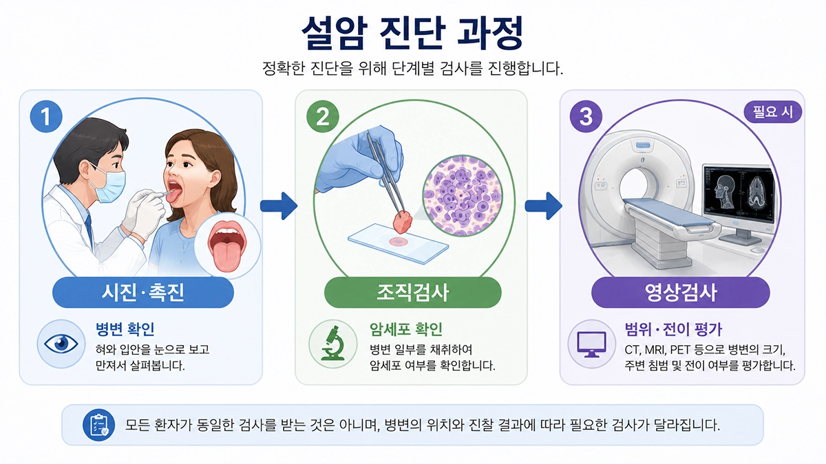 설암 초기증상으로 진료받을 때 시진과 조직검사, 필요 시 영상검사로 이어지는 검사 과정을 설명한 이미지