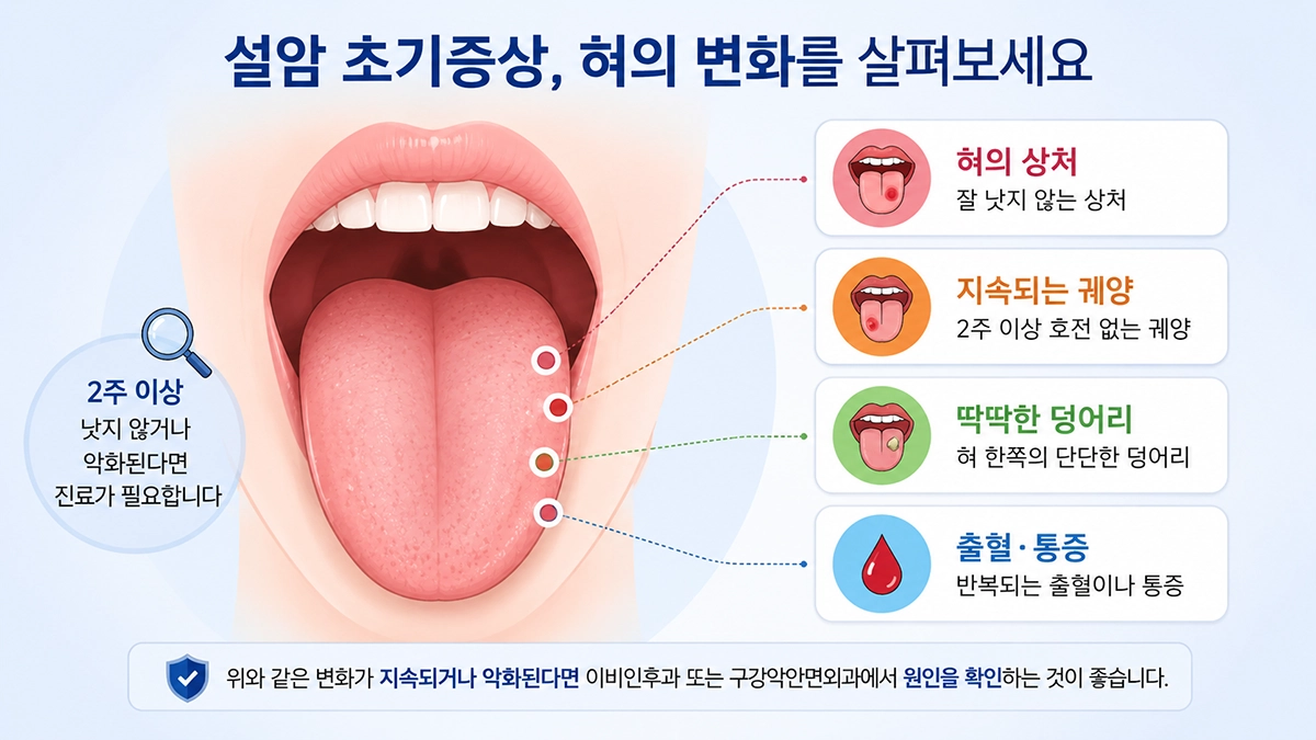 설암 초기증상으로 살펴볼 혀의 상처와 궤양, 덩어리를 보여주는 인포그래픽