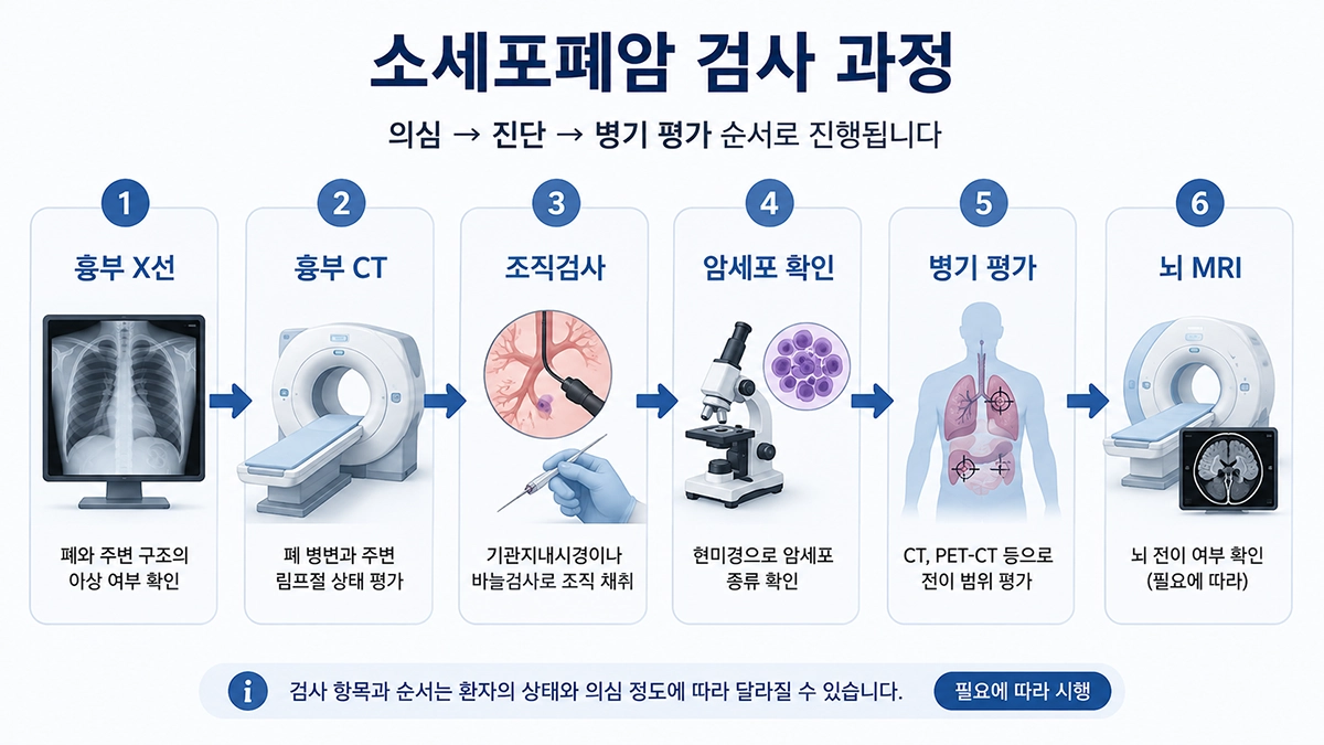 소세포폐암 진단에서 흉부 CT와 조직검사 및 병기 평가로 이어지는 검사 과정