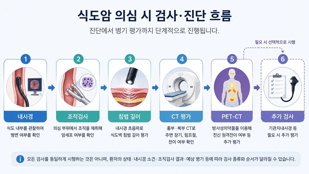 식도암 진단을 위한 위내시경 조직검사와 CT PET-CT 검사 과정을 보여주는 단계형 인포그래픽