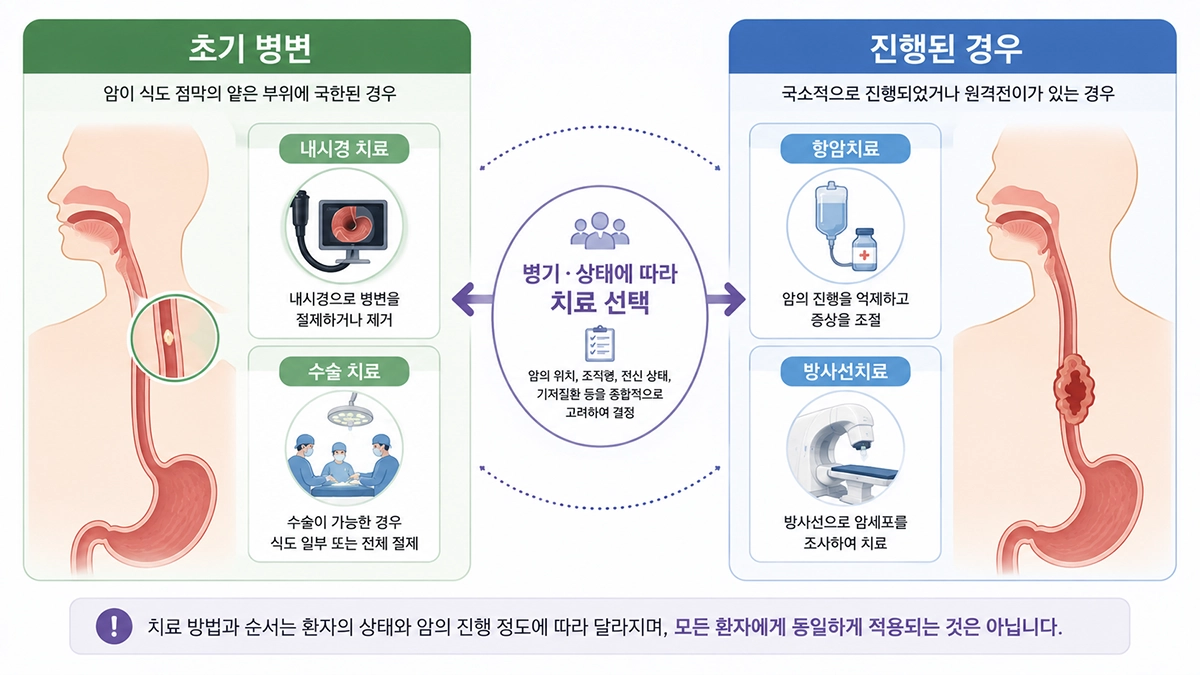 식도암 병기와 환자 상태에 따라 달라지는 내시경 수술 항암 방사선치료 비교 인포그래픽