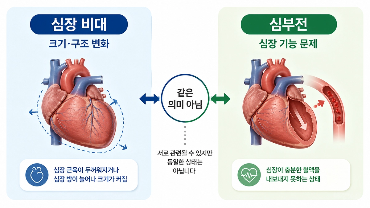 심장 비대와 심부전의 의미와 차이를 비교한 인포그래픽