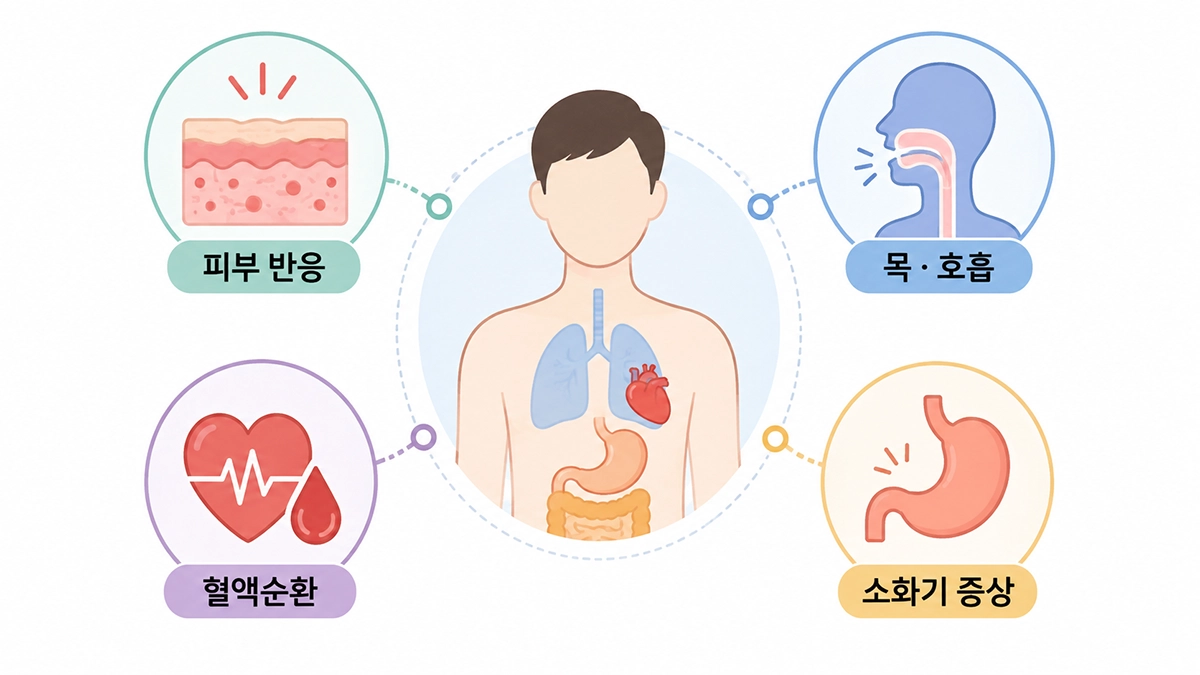 아나필락시스가 피부와 호흡기, 혈액순환, 소화기에 나타날 수 있음을 보여주는 인포그래픽